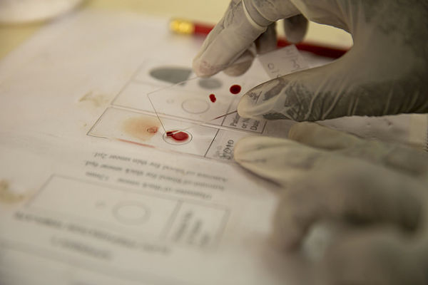A technician at work in a GSK lab focused on malaria research. (Photo: GSK/Flickr)