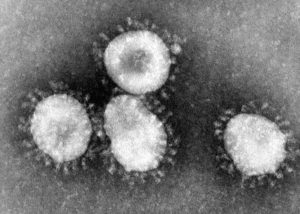 Photo of actual viruses