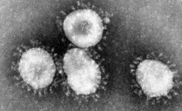 Photo of actual viruses