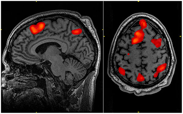 Learning to Use fMRI in Organizational Research